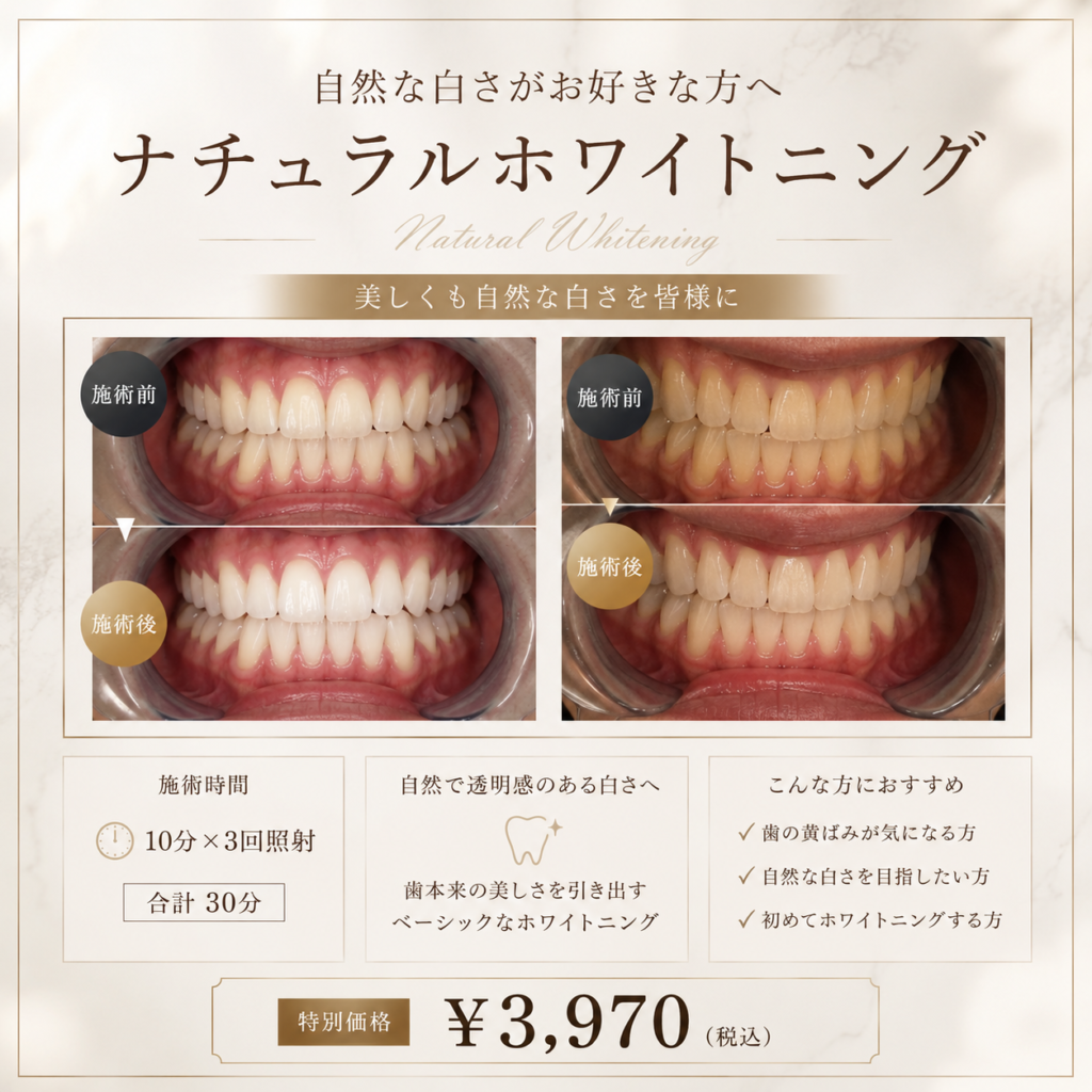 ナチュラルホワイトニング