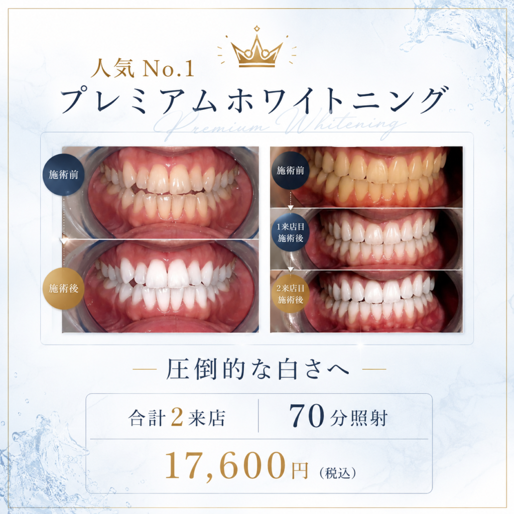 プレミアムホワイトニング